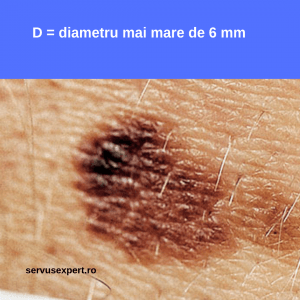 semne de cancer de piele