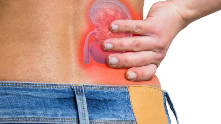 Excesul de calciu în urină. Măsuri obligatorii pentru evitarea litiazei