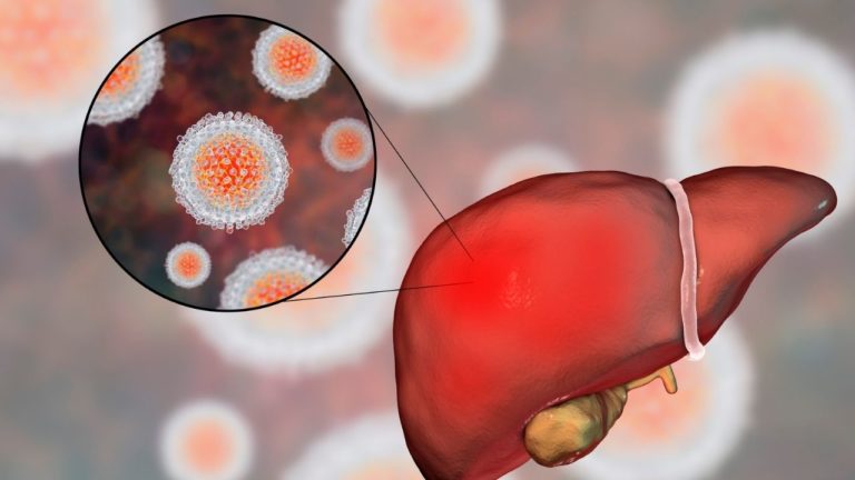 Hepatita autoimună