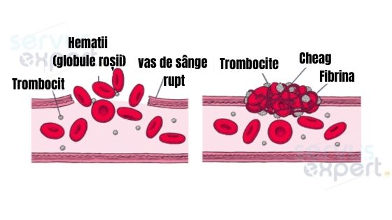 trombocite tromboza, vase de sange
