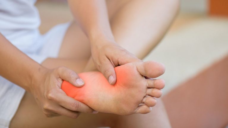 Fasciita plantară: durere de talpă și călcâi