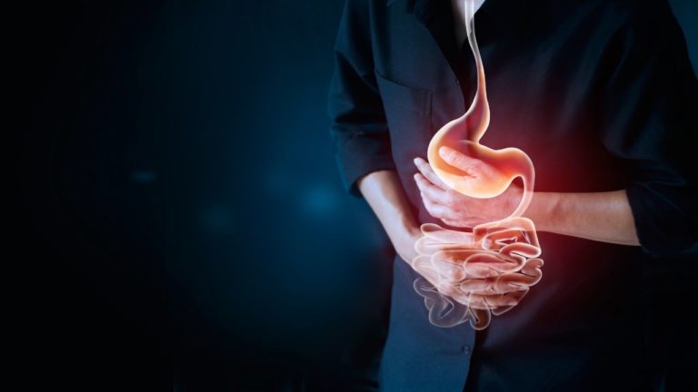 Hernie hiatală: cauză de arsuri gastrice si reflux
