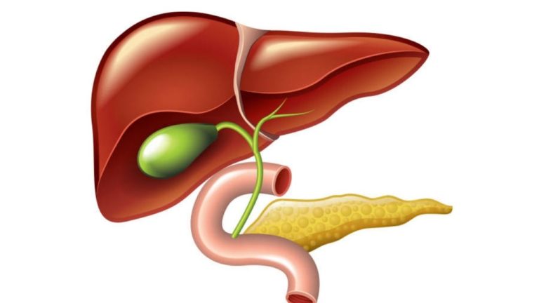 Colecistita acuta: simptome, analize, tratament