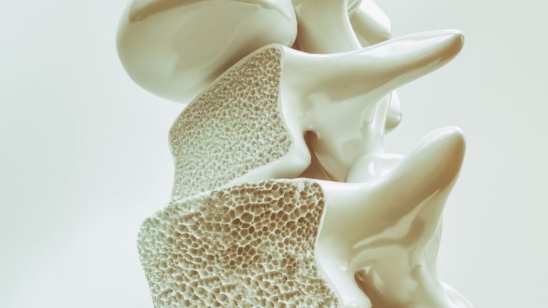 11 metode simple ca sa prevenim osteoporoza