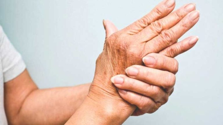 Artrita psoriazică: ce articulații sunt afectate?
