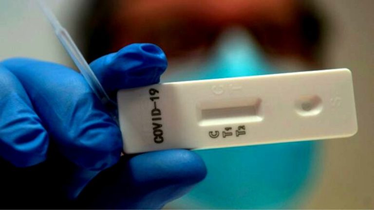 Testare Anticorpi dupa vaccinul COVID-19: cum interpretăm?