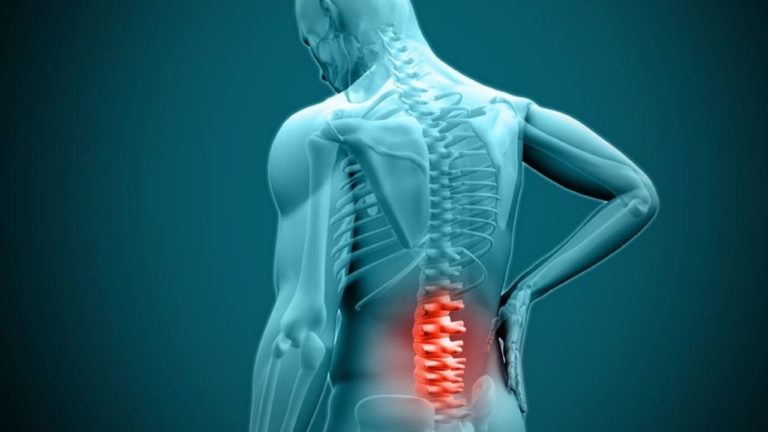 LOMBOSCIATICA. Ghid complet