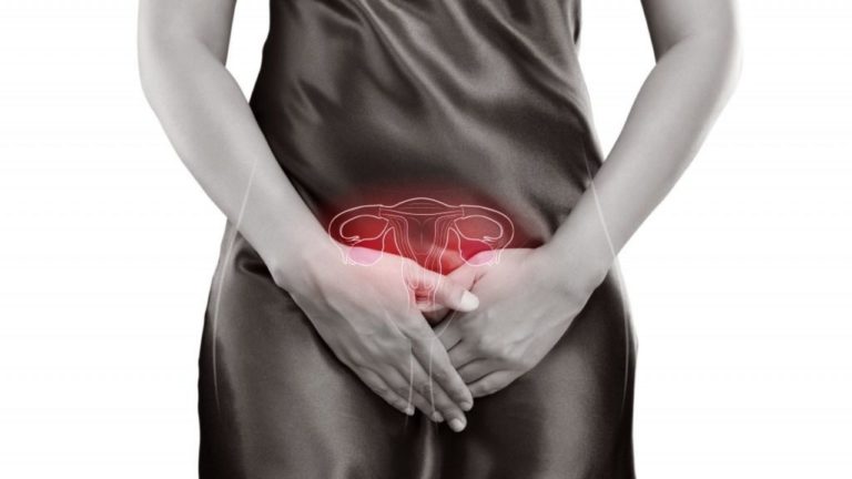 ENDOMETRIOZA Simptome care ne trimit la medic