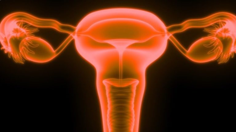 Hiperplazia de endometru (îngroșarea mucoasei uterului)