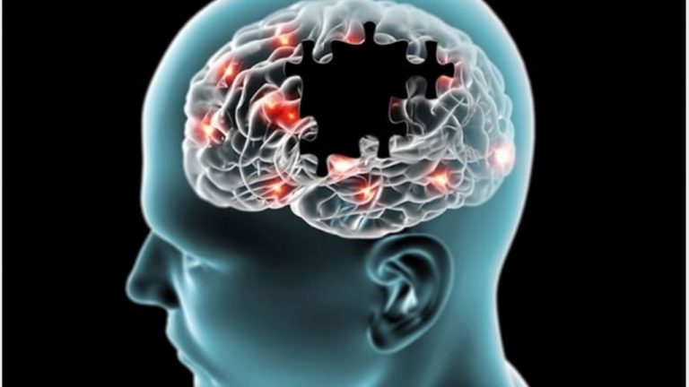Boala Alzheimer: medicament nou aprobat de FDA