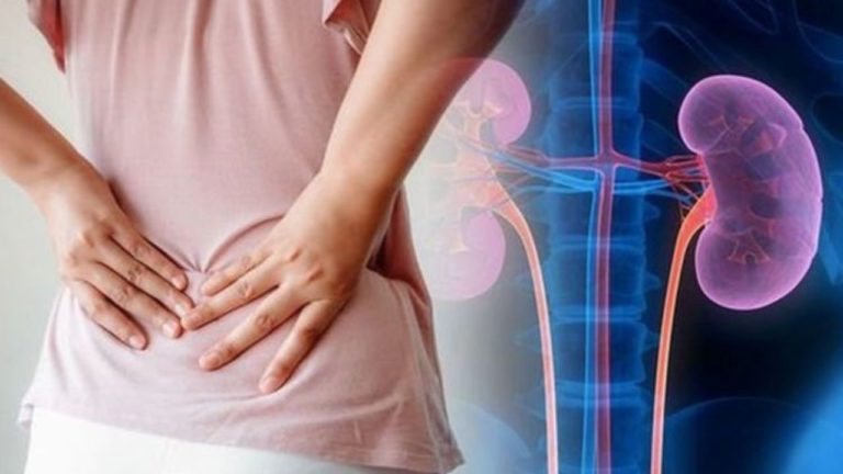 INFECTIE URINARA: Ghid vizual de simptome și tratament