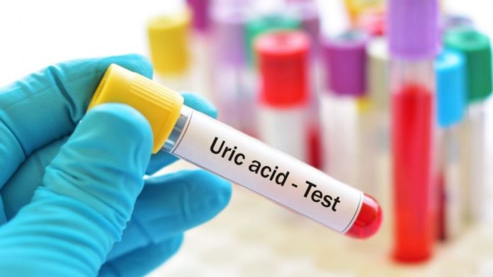 acid uric crescut studiu clinic noutati medicale