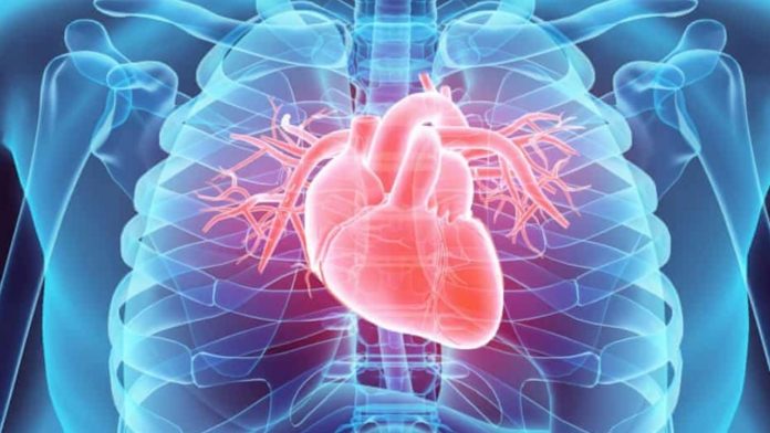 preinfarct sau infarct miocardic silentios