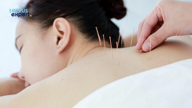 Acupunctura pentru bufeuri. De ce ar trebui să încerci?
