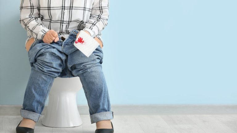 12 cazuri de cancer rectal vindecate complet