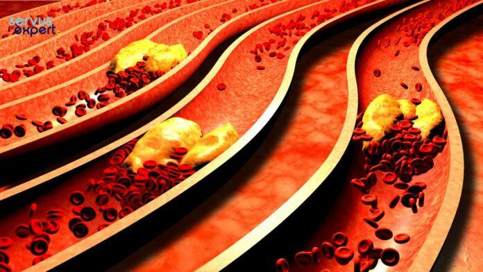 valorile colesterolului