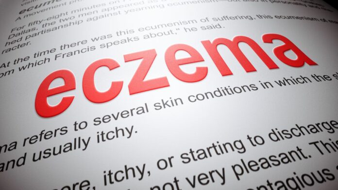 eczema atopică