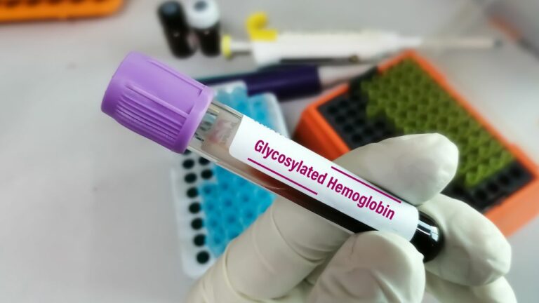 Hemoglobina glicozilată (glicata): corelația cu glicemia