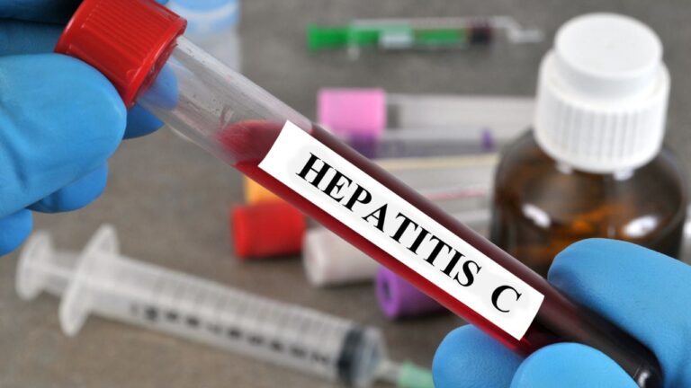 Hepatita C: cum scapi de infecție?