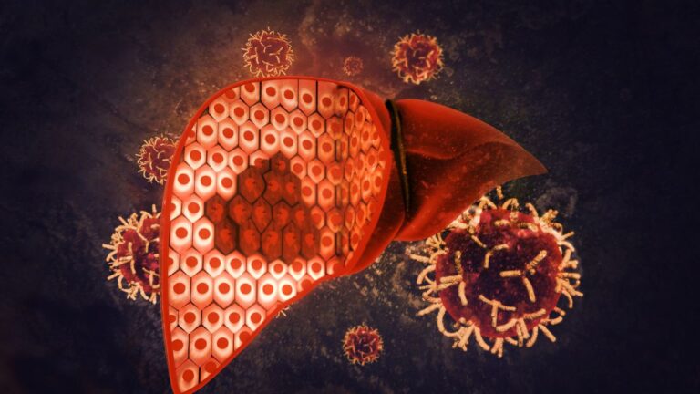 Ciroza hepatică: de ce apare și cum poate fi evitată?