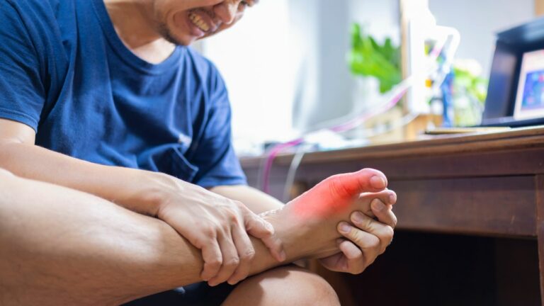 Acid uric crescut (hiperuricemie) : semne, depistare, tratament