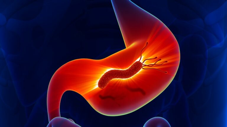 Helicobacter pylori. Simptome digestive frecvente