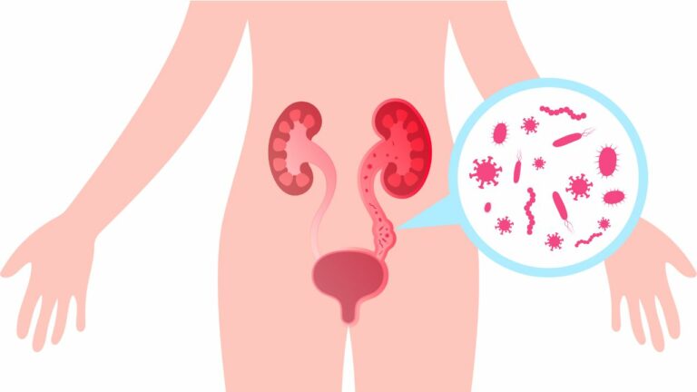 Infecții urinare la copii si bebeluși. Simptome după vârstă