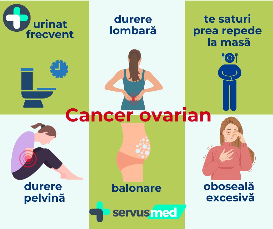 cancer de ovar