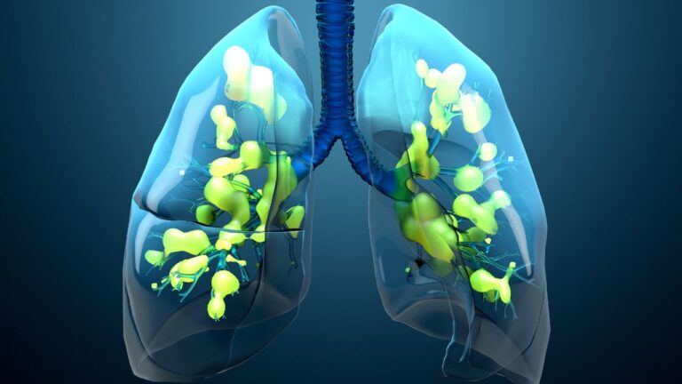 Pneumoniile: 10 informații care te ajută să te orientezi rapid