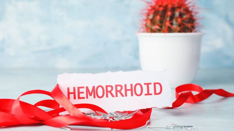 Calmarea hemoroizilor cu remedii naturale