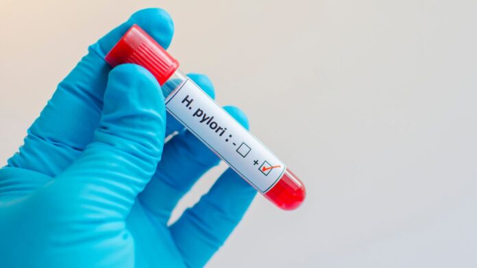 H.pylori: depistare și tratament